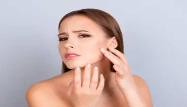 આરોગ્ય@શરીર: ચોમાસામાં ઘણીવાર સ્કિન સમસ્યા ત્રાસદાયક બને છે, જોકે છે સરળ ઉપચાર