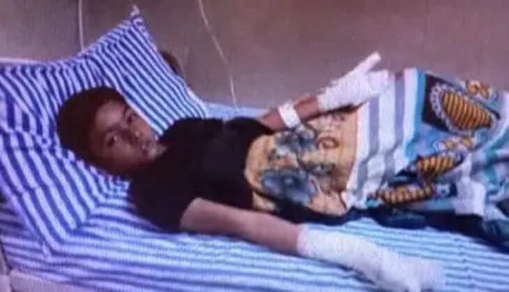 ઘટના@સુરત: વિજ્ઞાન મેળામાં પ્રયોગ દરમિયાન અકસ્માતની ઘટના બનતા એકવિદ્યાર્થી દાઝી જતા તેને સારવાર માટે હોસ્પિટલ ખસેડવામાં આવ્યો