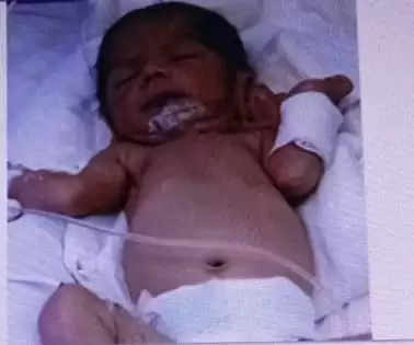 Update Surat biggest case of organ donation in history newborn baby gives new life to 6 people