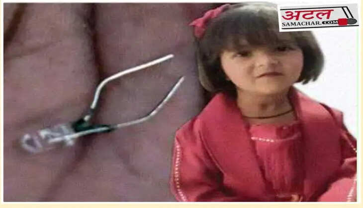 ઘટના@વડોદરા: 4 વર્ષની બાળકી રમવાના ઉત્સાહમાં ચોકલેટની સાથે LED બલ્બ ગળી ગઈ